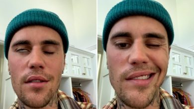 Justin Bieber, yüz felci hastalığıyla ilgili son durumunu paylaştı