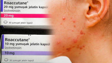 Roaccutane nedir? Nasıl kullanılır? Roaccutane yan tesirleri nasıl geçer?